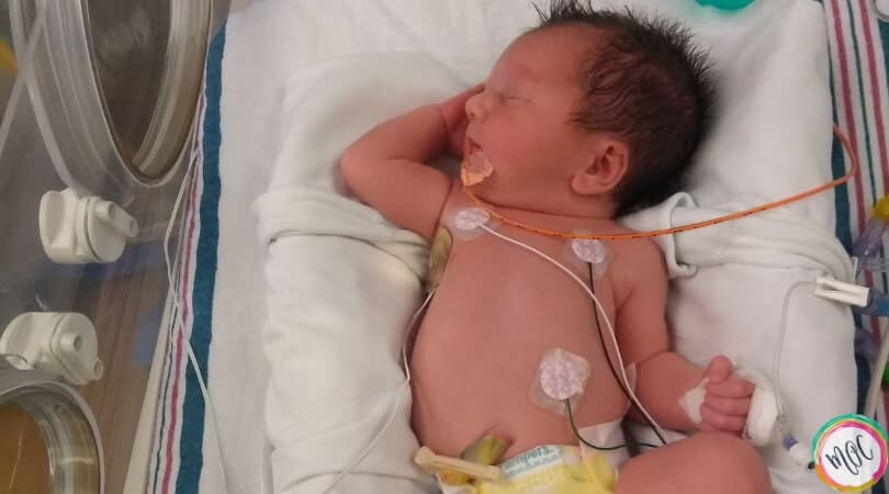 Challenges Benefits yes For Real Of A Premature Baby In The NICU